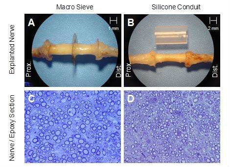 Prosthetic electrodes