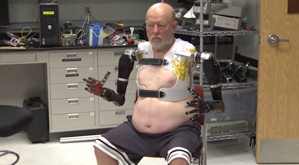 bionics-les-baugh-amputee
