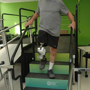 emg-powered-prosthetic-legs