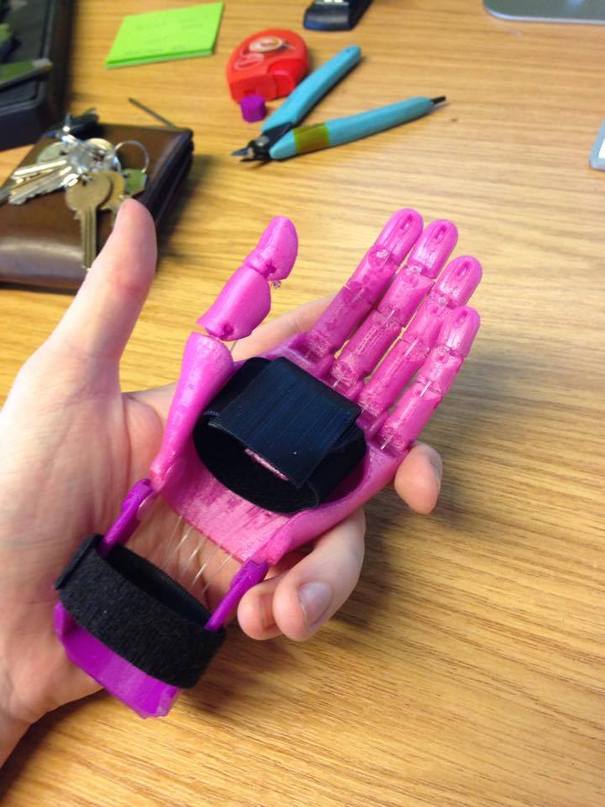 ۳۶۱۱۸۱-glasgow-3d-printer-makes-rinoa-meisak-new-prosthetic-pink-hand-credit-step-3d