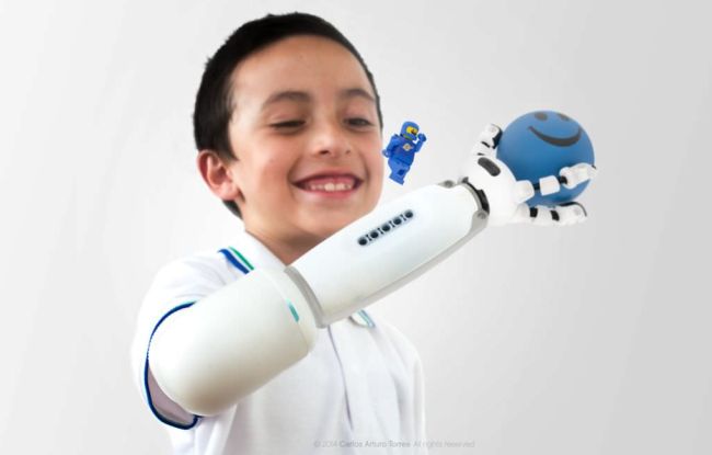 IKO-prosthetic-system-by-Carlos-Arturo-Torres-from-the-UMEA-Institute-of-design