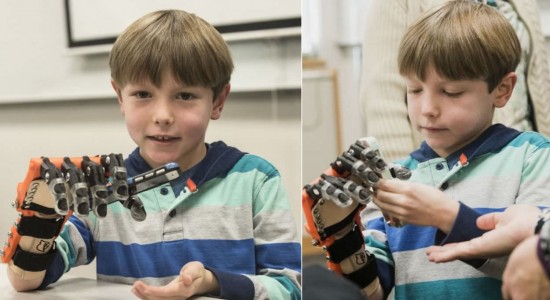 Lucas-Abraham-3D-printed-bionic-hand_4