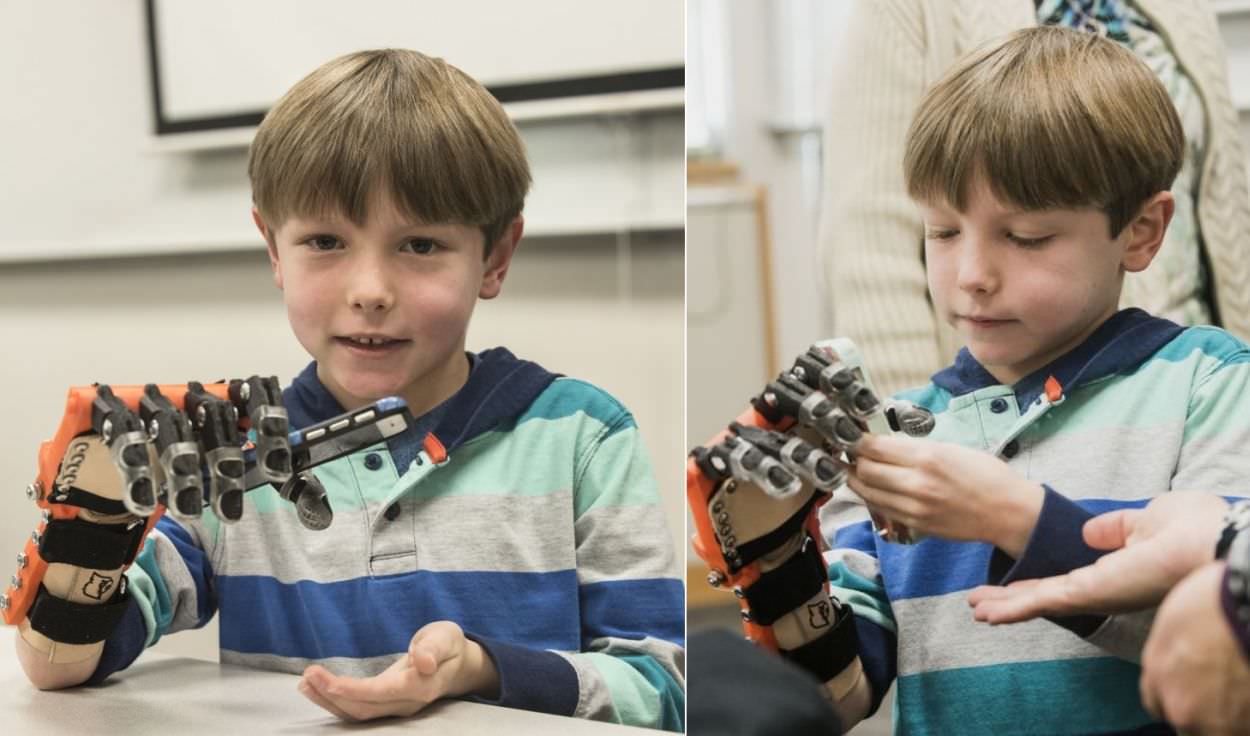 Lucas-Abraham-3D-printed-bionic-hand_4