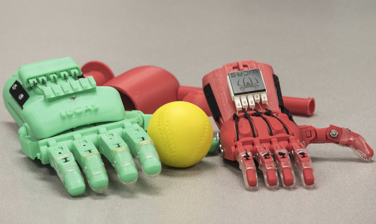 Lucas-Abraham-3D-printed-bionic-hand_5