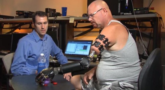 بازوی مصنوعی رباتیک کنترل‌شونده با حرکت اشاره