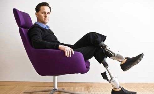 mit-professor-shows-us-his-incredible-bionic-prosthetics-that-move-like-real-legs