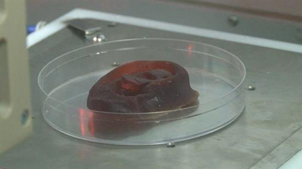 uk-hospital-first-3d-bioprinted-noses-ears-human-cells4