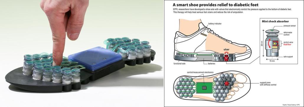جلوگیری از زخم‌های دیابتی با کفی کفش هوشمند