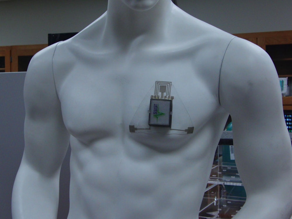 پچ قفسۀ سینۀ HET - برای پیش بینی حمله آسم
