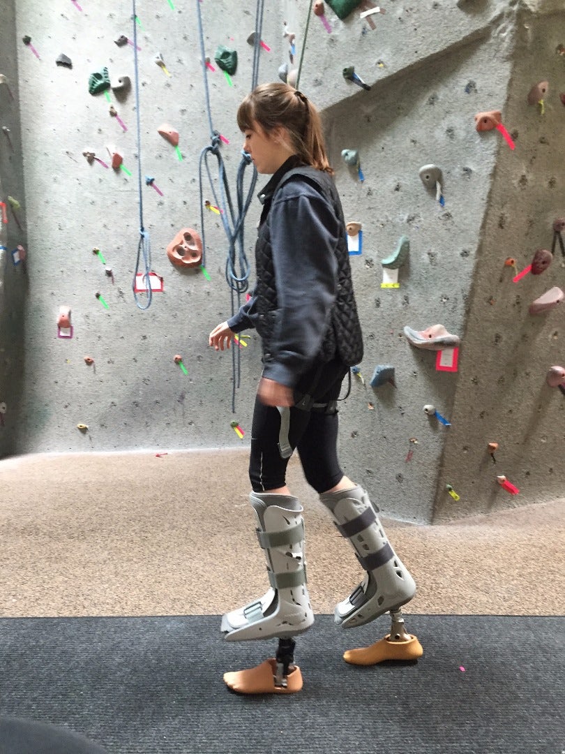 پروتزی برای راه رفتن معلولان با کفش پاشنه بلند - پروتز پای زنانه