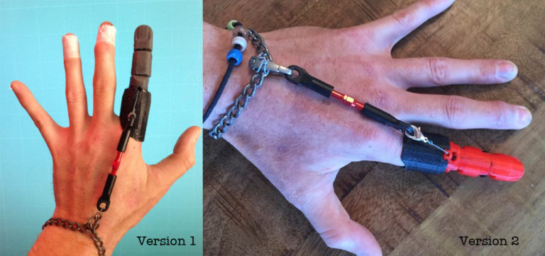 معرفی انگشت مصنوعی چاپ سه بعدی Knick Finger