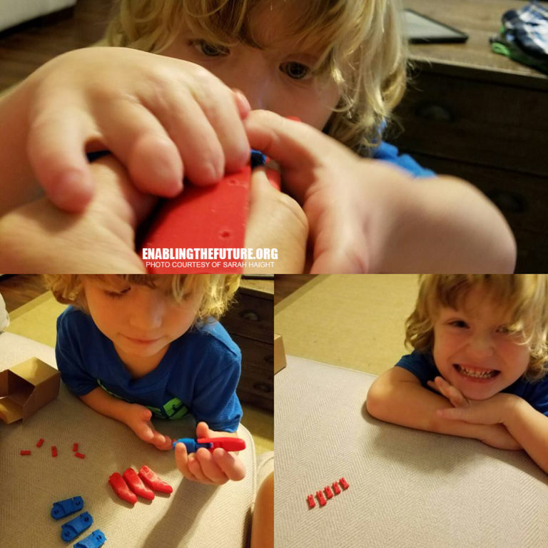 چاپ سه بعدی دست برای یک کودک