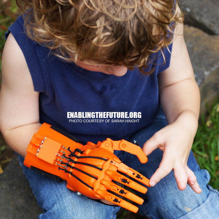چاپ سه بعدی دست برای یک کودک