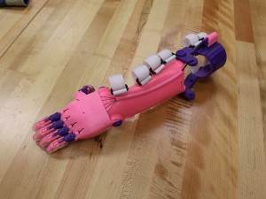 ساخت دست مصنوعی کودک با چاپ سه بعدی برای دختر بچه پنج ساله