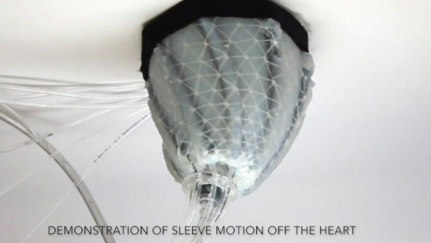 ساخت پوشش رباتیک نرم برای کمک به تپش قلب