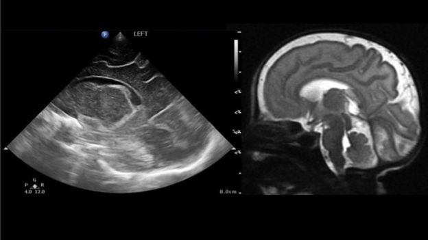  کوچک‌ترین دستگاه MRI جهان برای تشخیص بیماری‌های نوزادان