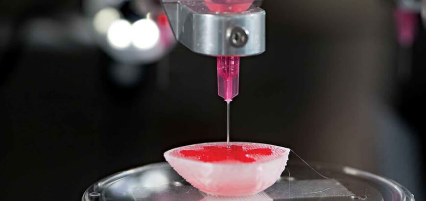 معرفی محصولات تولیدی چاپ سه بعدی در حوزه‌ی سلامت (بخش دوم)