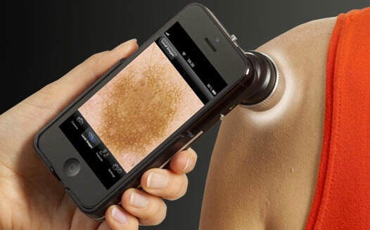پویش پوست با یک دوربین کوچک، فناوری پزشکی سال ۲۰۱۸