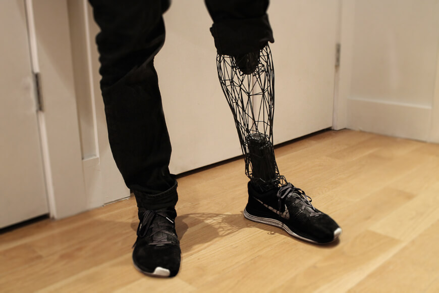 پای مصنوعی تولید شده با چاپ سه بعدی