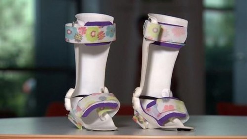 استفاده از چاپ سه بعدی در تولید ارتز پا برای کودکان