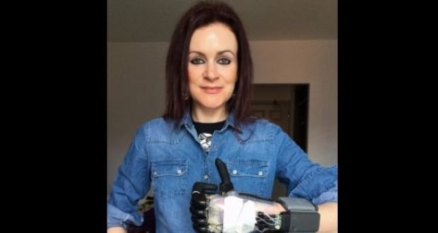 تحول در زندگی یک مادر با دست بیونیک شرکت Touch Bionics
