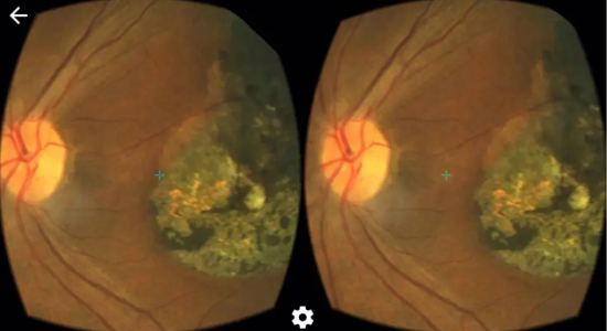 RetinaScope : برنامه گوشی VR مناسب دانشجویان چشم‌ پزشکی