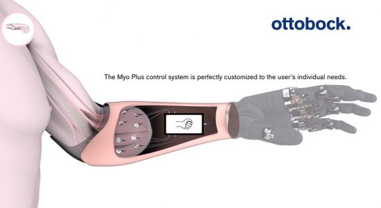 تحول پروتز های دست شرکت Ottobock با فناوری بازشناسی الگو