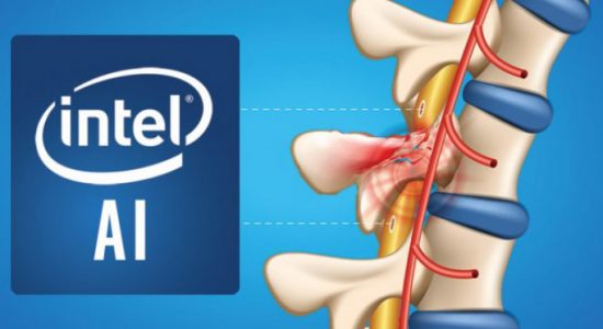 آغاز پژوهش اینتل و دانشگاه براون برای ایجاد یک سامانه هوش مصنوعی و کمک به بیماران آسیب نخاعی