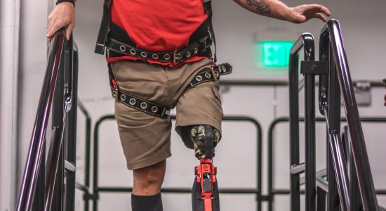 نخستین پای بیونیک خودران برای معلولان قطع عضو