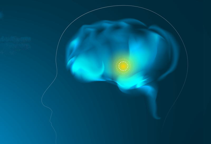  Infinity Deep Brain Stimulation یا DBS قسمتی از اعماق مغز را تحریک می‌کند.