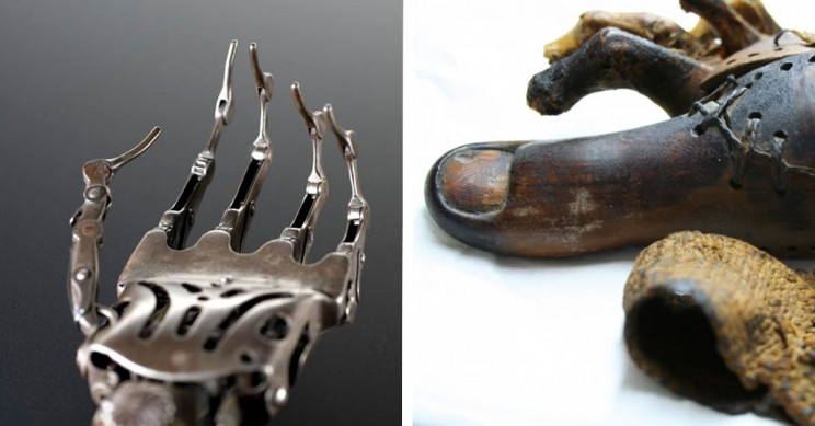 دست مصنوعی فلزی و انگشت چوبی مصنوعی ، اندام مصنوعی در طول تاریخ
