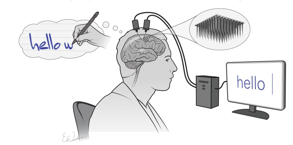 رابط مغز و رایانه دست خط ذهنی معلولان را به متن روی نمایشگر تبدیل میکند