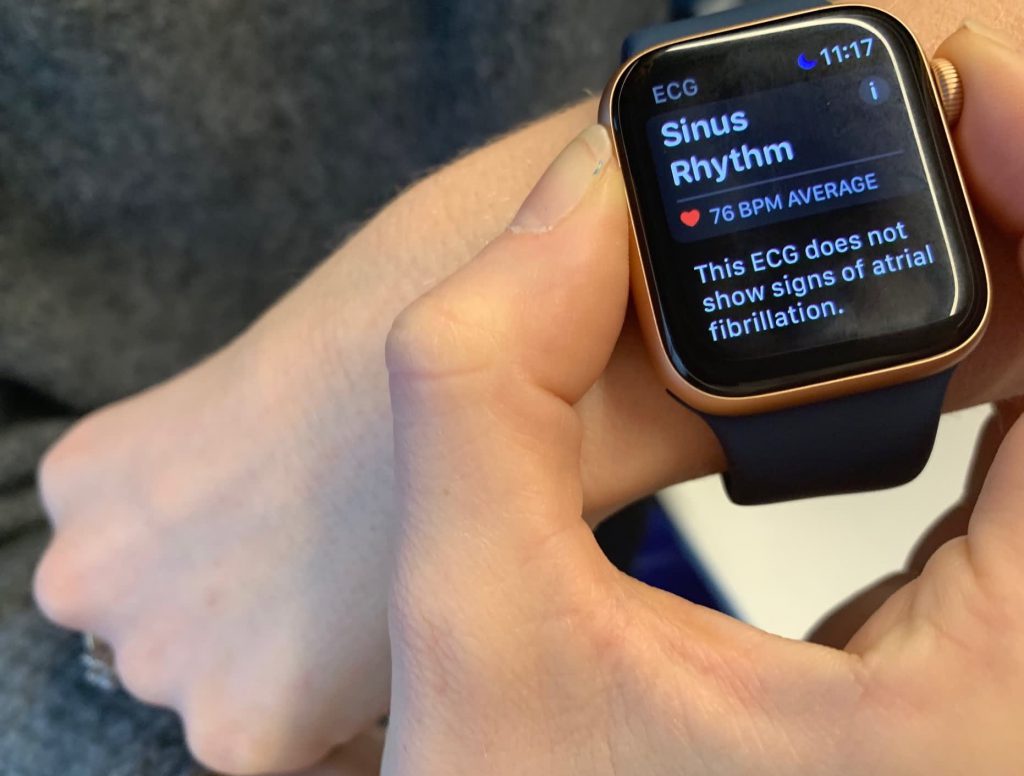  استفاده از ساعت هوشمند Apple برای تشخیص فیبریلاسیون دهلیزی 