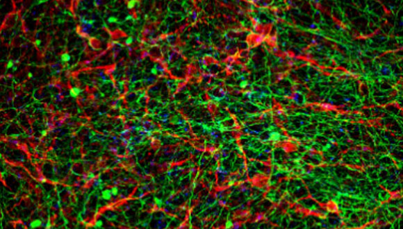  شبکه عصبی حاوی نورون‌های حرکتی 