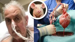 برای نخستین بار، در آمریکا قلب خوک به یک انسان پیوند زده شد