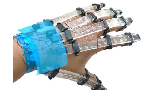 دستکش های چاپ سه بعدی برای توانبخشی بیماران سکته مغزی