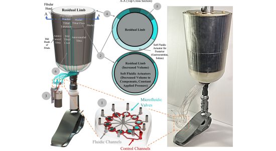 تسکین بیماران قطع عضو دیابتی با پروتزهای رباتیک مبتنی بر ریزسیال