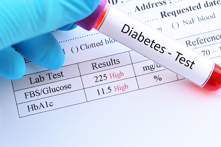 diabetes test