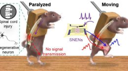 آیا انسان مبتلا به ضایعه نخاعی میتواند راه برود؟ کشف سرنخ ها با فناوری نورومورفیک