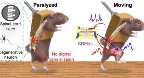 آیا انسان مبتلا به ضایعه نخاعی میتواند راه برود؟ کشف سرنخ ها با فناوری نورومورفیک