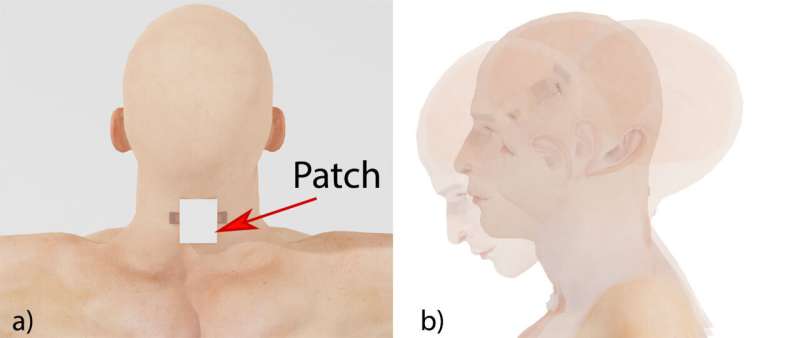 حسگر پوشیدنی جدید برای اندازه‌گیری فشار گردن ممکن است ضربه مغزی احتمالی را تشخیص دهد