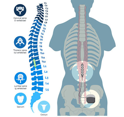 EPIDURAL STIMULATION