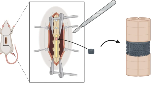 روشی جدید برای ترمیم بافت نخاع