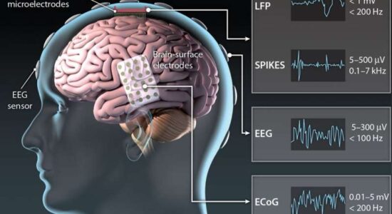 پروتز عصبی از فعالیت مغز برای رمزگشایی گفتار استفاده میکند