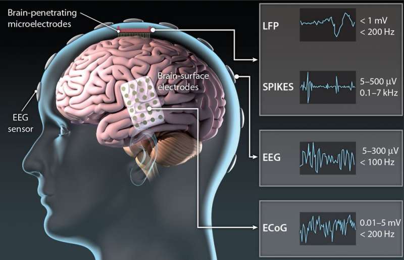 پروتز عصبی از فعالیت مغز برای رمزگشایی گفتار استفاده میکند
