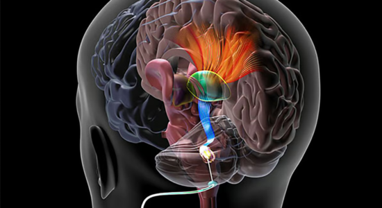 ضربان ساز کاشت شده در مخچه در Cleveland برای بهبود سکته مغزی