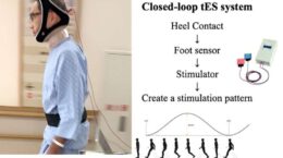 تحریک مغز، راه رفتن بیماران مبتلا به پارکینسون را بهبود بخشید
