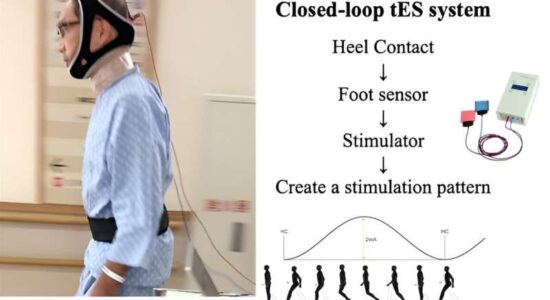 تحریک مغز، راه رفتن بیماران مبتلا به پارکینسون را بهبود بخشید