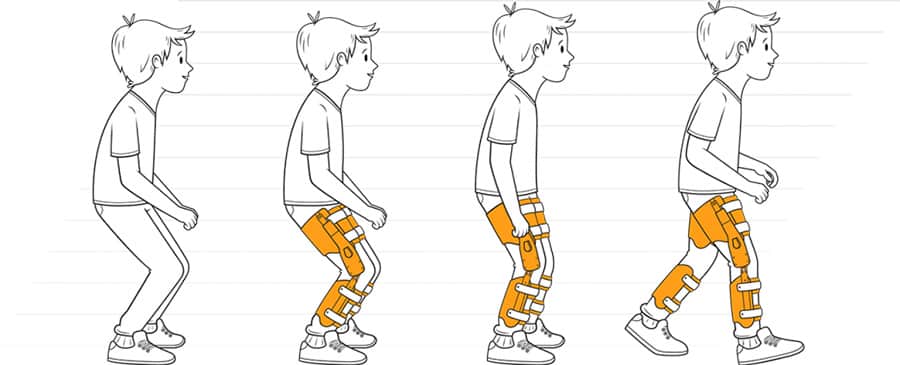 اسکلت بیرونی پایین تنه که به کودکان فلج مغزی کمک میکند که ایستاده تر و مطمئن تر راه بروند 