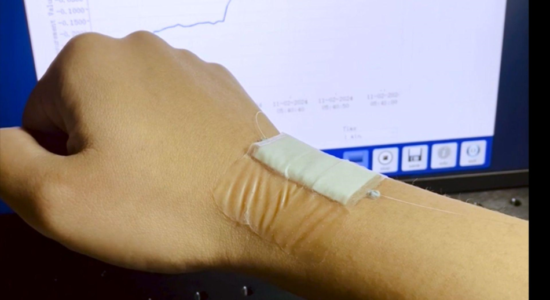 The soft and flexible wearable sticker sensor can be worn for long hours and even picks slight movements that conventional sensors miss.